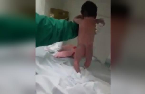 Bebé con minutos de nacido «camina» en plena sala de parto
