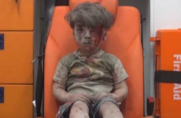 ¿Recuerdas al niño sirio herido en un bombardeo que se hizo viral? Así está ahora